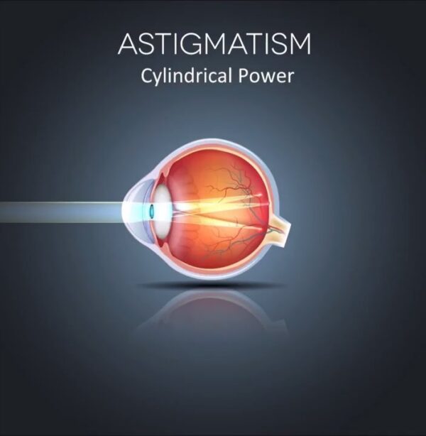 ACUVUE OASYS FOR ASTIGMATISM (MONTHLY TORIC) (5)
